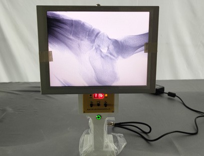 Portable X-ray machine imaging effect Portable X-ray machine imaging effect